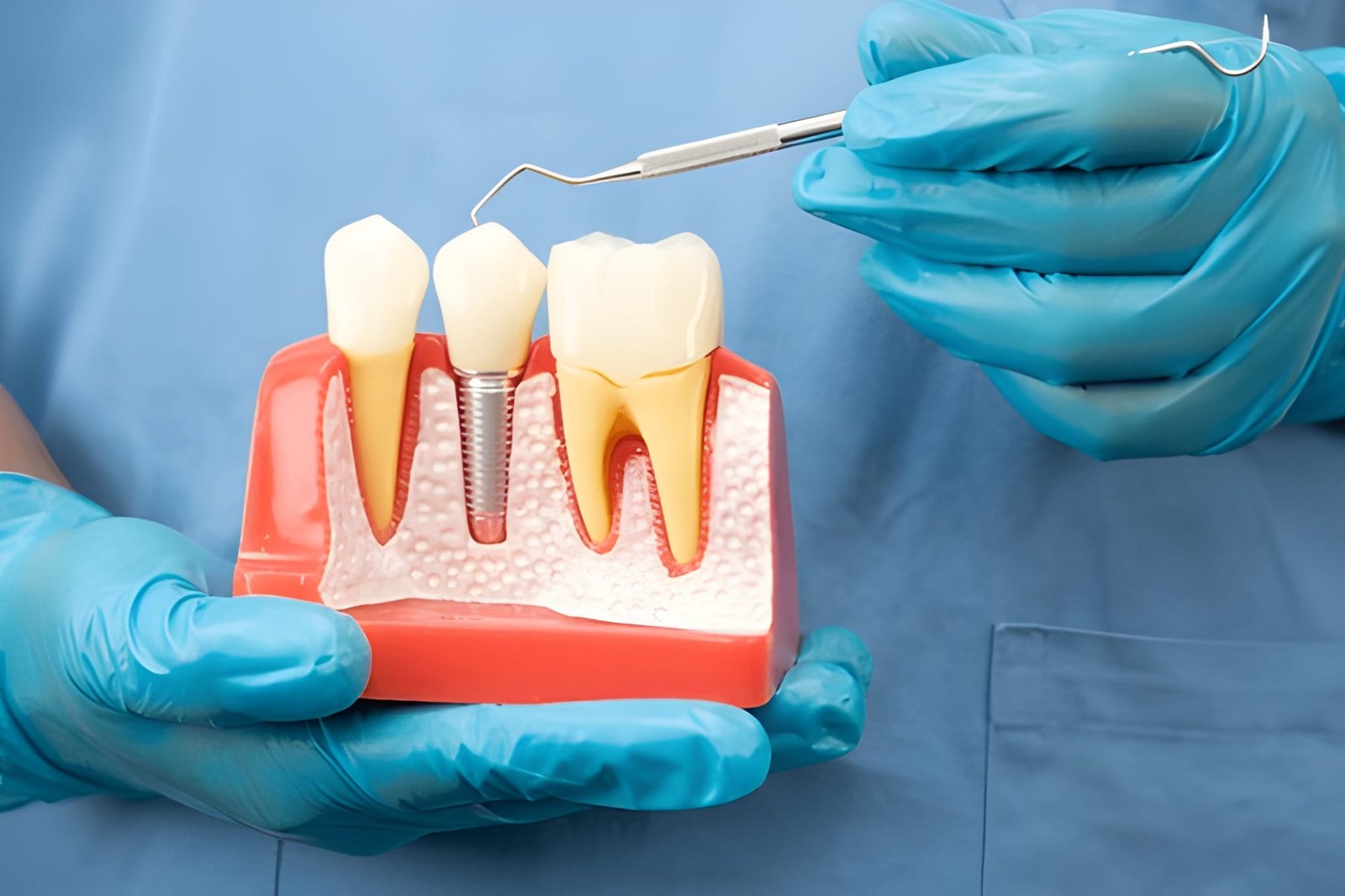 Is Getting a Dental Implant Really as Natural-Looking and Long-Lasting as They Say?
